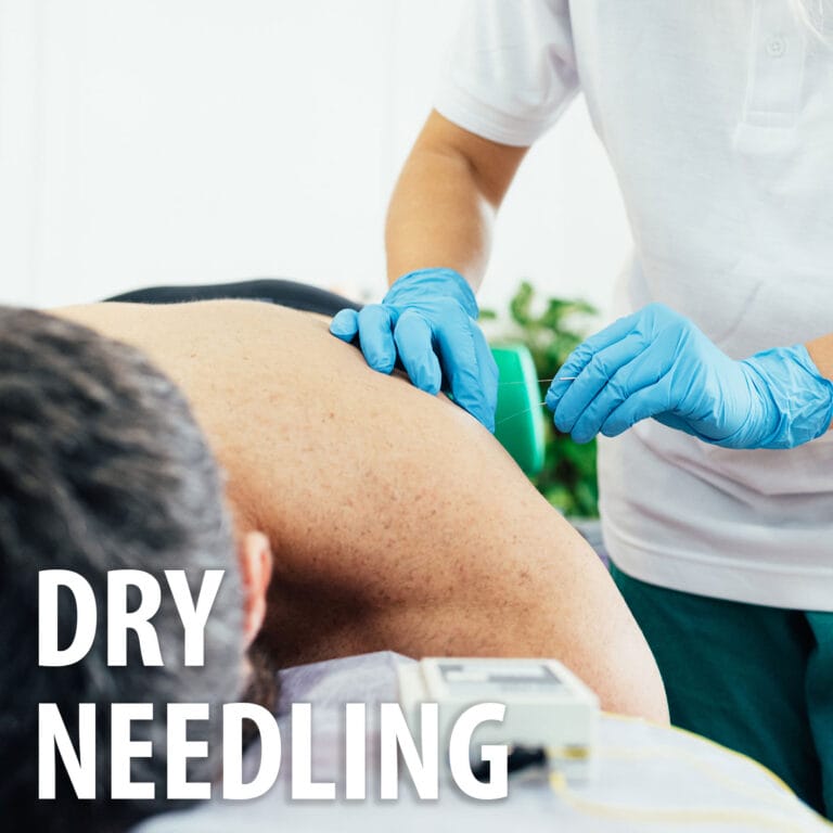 Patient receiving dry needling from physical therapist